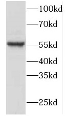 FKBP4 antibody|FKBP4抗体 FNab031