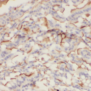 CDH17 antibody|CDH17抗体