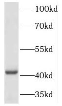 HOXA2 antibody|HOXA2抗体
