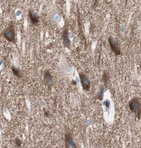 UNC5A antibody|UNC5A抗体 FNab092