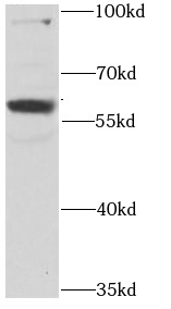 RPS6KL1 antibody|RPS6KL1抗体