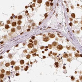 ATR antibody|ATR抗体