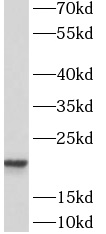 ASF1A antibody|ASF1A抗体 FNab006