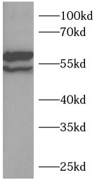 RUNX2 antibody|RUNX2抗体