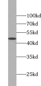 UBAC1 antibody|UBAC1抗体
