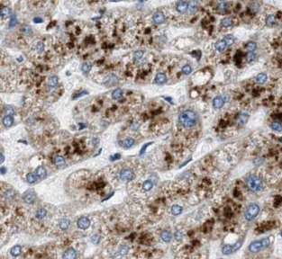 SERPINA1 antibody|SERPINA1抗体 F