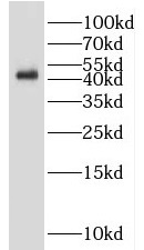 IDH1 antibody|IDH1抗体 FNab04117