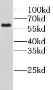LPCAT1 antibody|LPCAT1抗体 FNab0