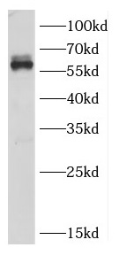 CRMP1 antibody|CRMP1抗体