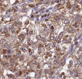 UBE2B antibody|UBE2B抗体