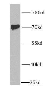 IGF2BP1 antibody|IGF2BP1抗体