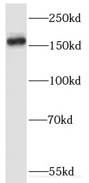 ERBIN antibody|ERBIN抗体