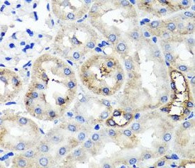 TNFAIP6 antibody|TNFAIP6抗体