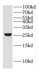 GJB2 antibody|GJB2抗体 FNab01857
