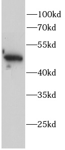 AP2M1 antibody|AP2M1抗体