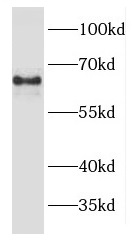 EPHX2 antibody|EPHX2抗体
