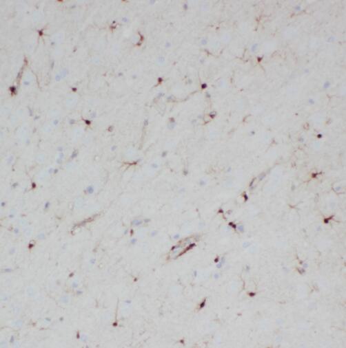 SPAG16 antibody|SPAG16抗体