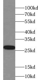 IL37 antibody|IL37抗体 FNab04275