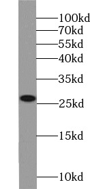 ARHGDIB antibody|ARHGDIB抗体 FNa