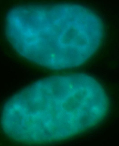 RECQL5 antibody|RECQL5抗体