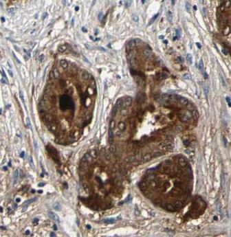 HSPA5 antibody|HSPA5抗体 FNab099