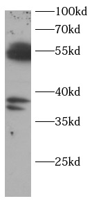 CASP8 antibody|CASP8抗体 FNab100