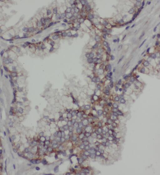 PDE9A antibody|PDE9A抗体