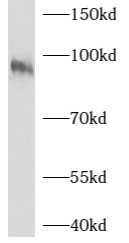 AXIN1 antibody|AXIN1抗体