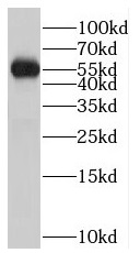 PTPN4 antibody|PTPN4抗体