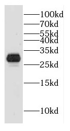 DHRS2 antibody|DHRS2抗体