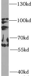 PIK3R1 antibody|PIK3R1抗体 FNab0