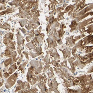 ACTC1 antibody|ACTC1抗体 FNab003