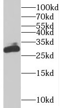 BIN3 antibody|BIN3抗体 FNab00900