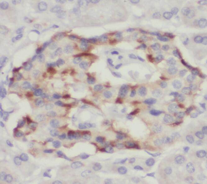 STK33 antibody|STK33抗体