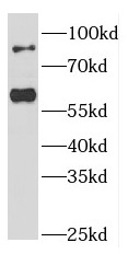 FOXP1 antibody|FOXP1抗体