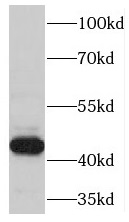 Tspyl4 antibody|Tspyl4抗体
