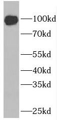ELF1 antibody|ELF1抗体 FNab02734