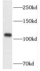 HGS antibody|HGS抗体