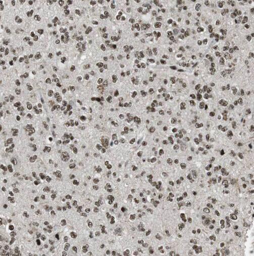 SNRPN antibody|SNRPN抗体