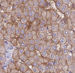 AMT antibody|AMT抗体