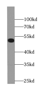 AGMO antibody|AGMO抗体