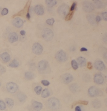 PDP2 antibody|PDP2抗体