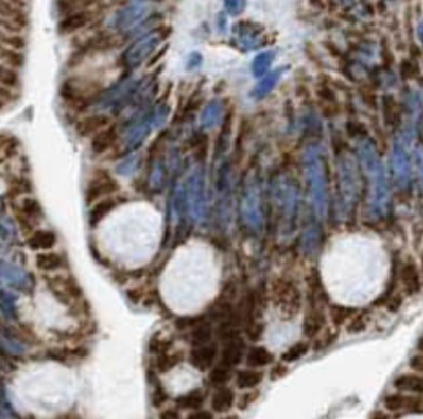 KRT20 antibody|KRT20抗体 FNab022