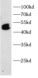 IRF5 antibody|IRF5抗体 FNab10757