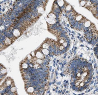 SLC2A2 antibody|SLC2A2抗体 FNab0