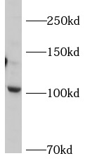 AP2A2 antibody|AP2A2抗体