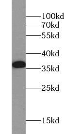 WNT7A antibody|WNT7A抗体