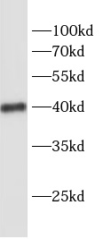SCD antibody|SCD抗体