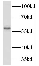 TBX6 antibody|TBX6抗体