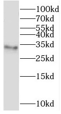 TMEM38A antibody|TMEM38A抗体